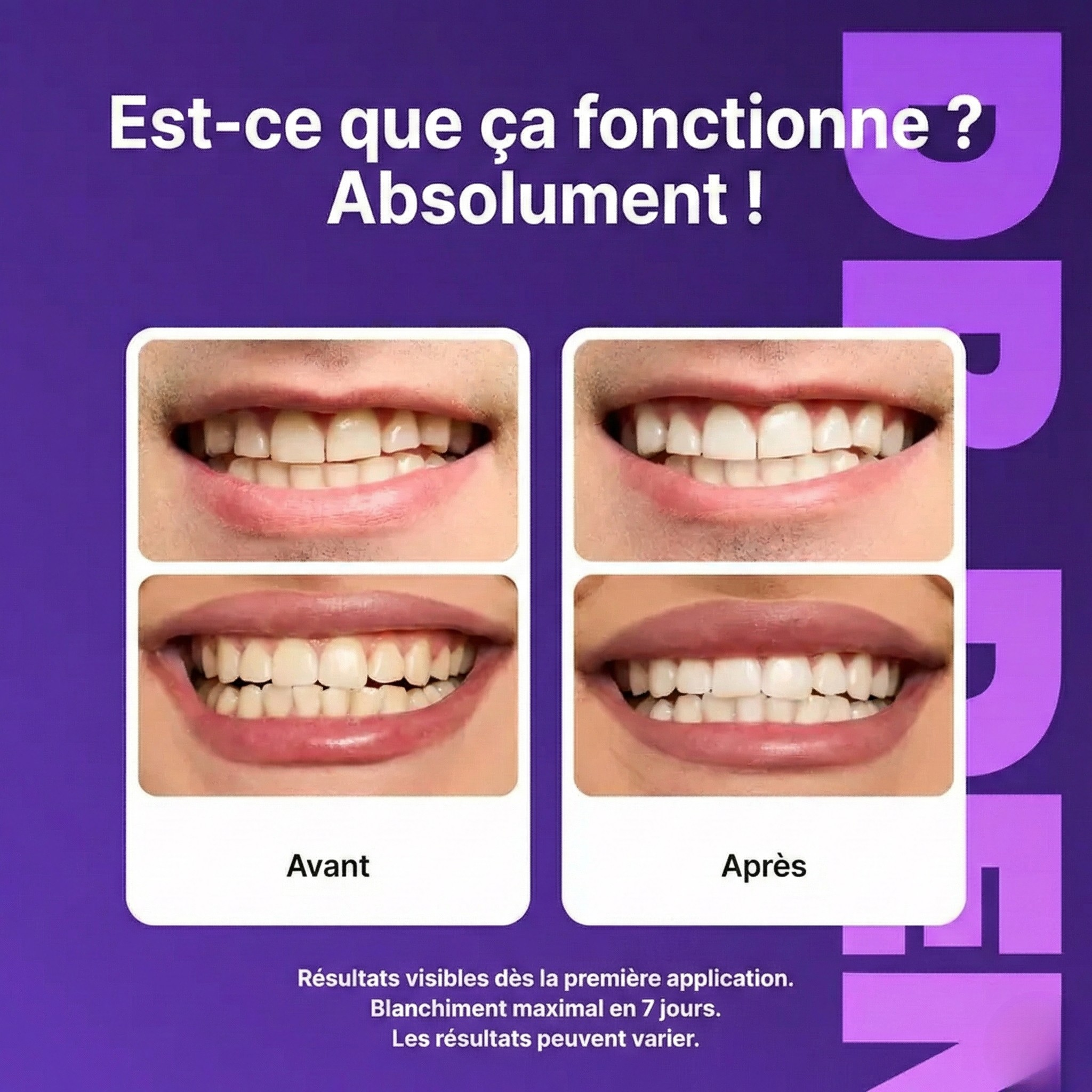 Bandes Blanchissantes Violettes