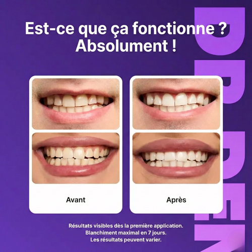 Bandes Blanchissantes Violettes